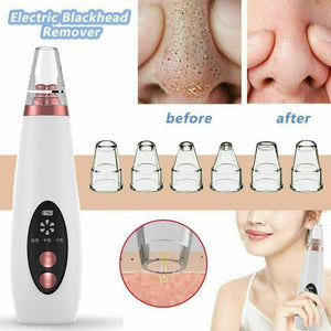 Pore and blackhead cleaner